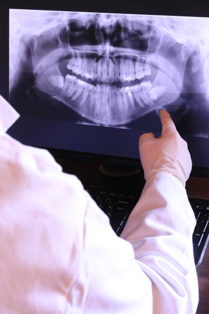 Best Emergency Dentist for Knocked-Out Tooth in Country Lake Estates, NJ