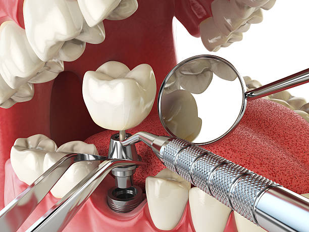 Best Mobile Emergency Dentist in Country Lake Estates, NJ